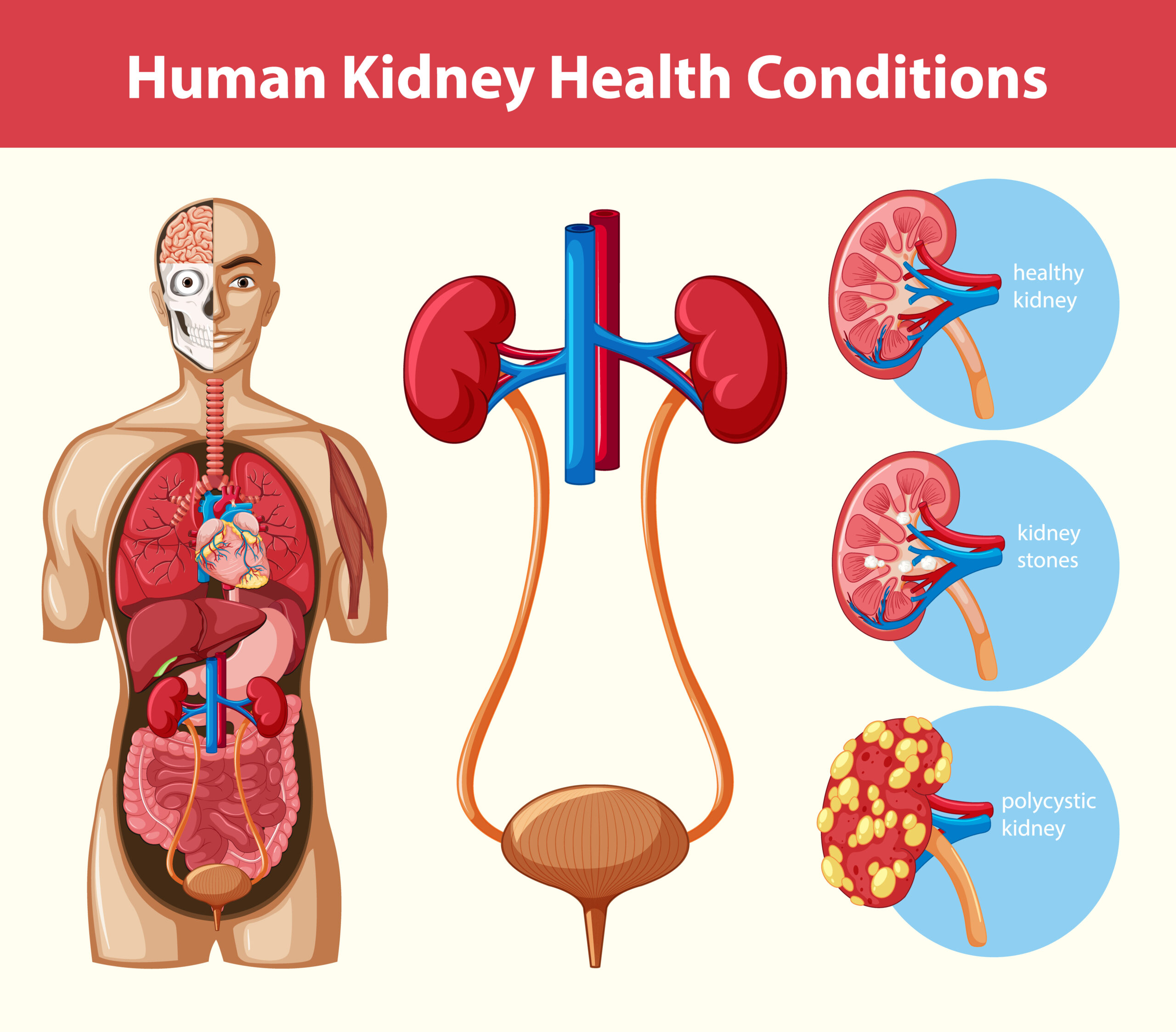 How to Detox Your Kidneys