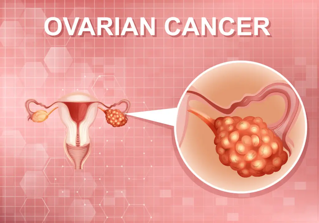 Ovarian Health