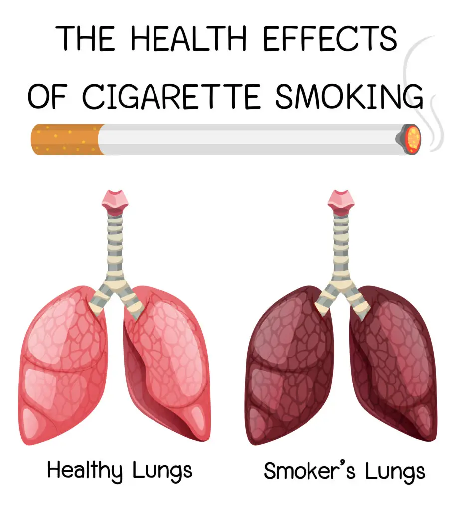 Smoker Lungs vs Healthy Lungs